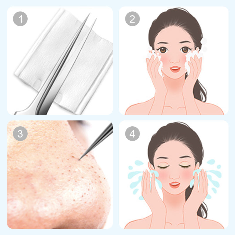 💓💥2025HOTSALE💥Medical grade blackhead cell clip tool set