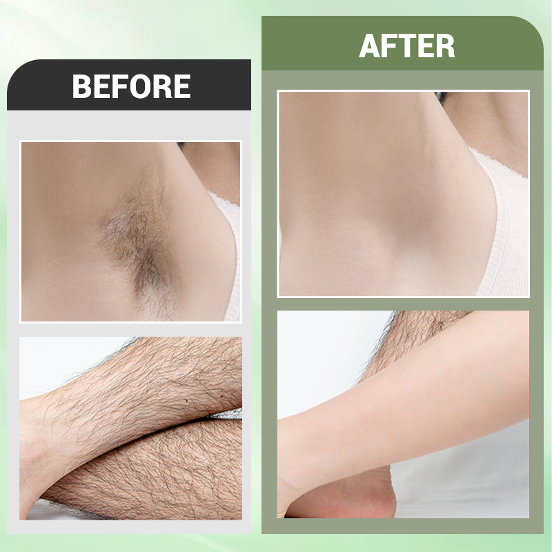 🤩Hair Removal Cream Kit for Women🤩