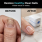 🏠💎 50% OFF! Stop waiting for your nail polish to dry only to smear it all over your keyboard anyway! This portable blue-light wonder cures, strengthens, and makes your nails shine as if you just came from the salon.