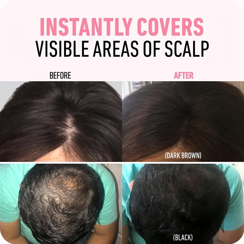 🎉53K+ Sold 💇 Hairline Powder Fit All Hair Color, Waterproof Root Touch Up Concealer For Grey & Sparse Hair