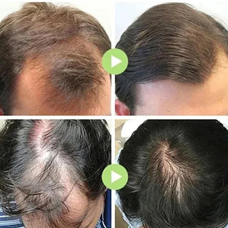 💥Gray Hair Eliminator👉New Upgrade❗Hair Colorizer with Comb⏳Limited time offer 50% off 😍Many hair colors to choose from!