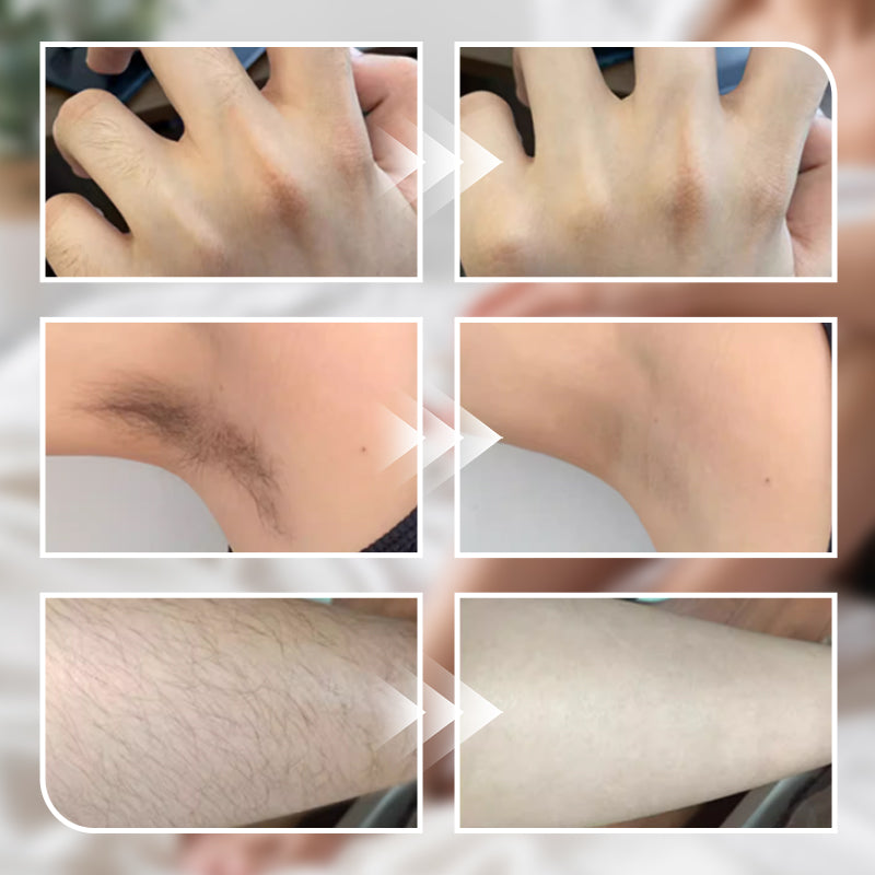 Gentle Hair Removal Cream for Men and Women