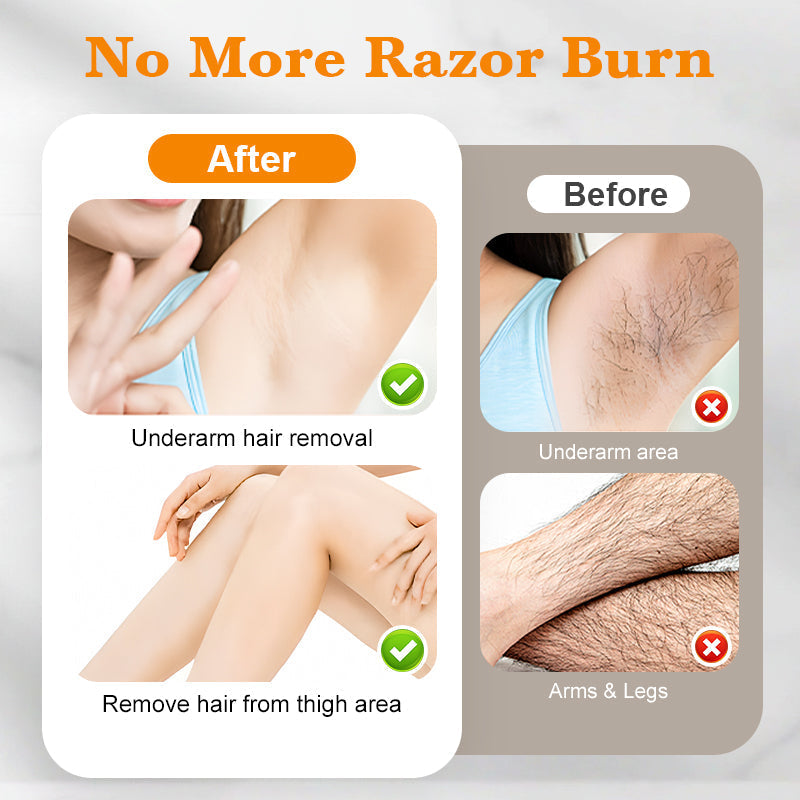 🔥Buy 2 Get 1 Free🔥100ml No Irritation Hair Removal Spray