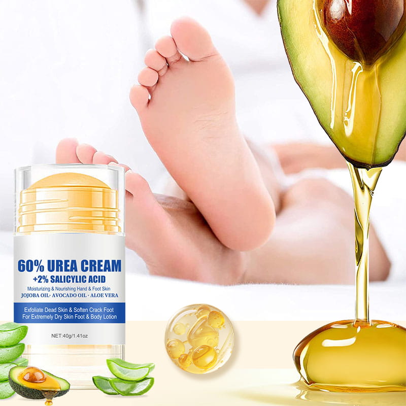Moisturizing Foot Cream for Calluses