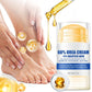 Moisturizing Foot Cream for Calluses