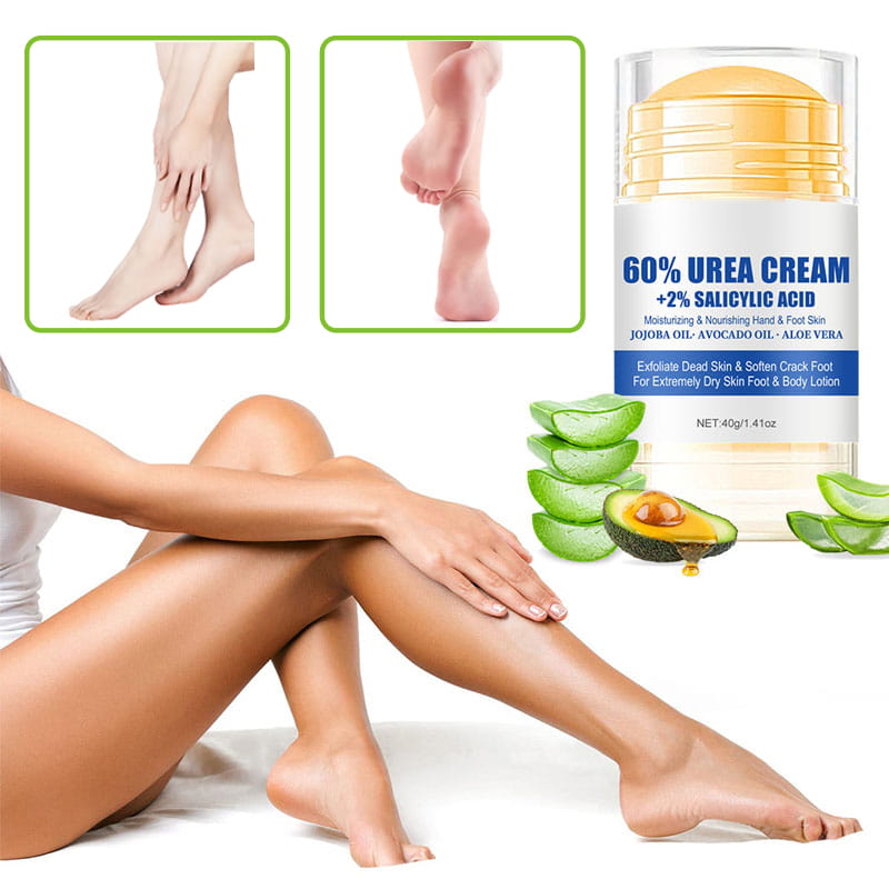 Moisturizing Foot Cream for Calluses