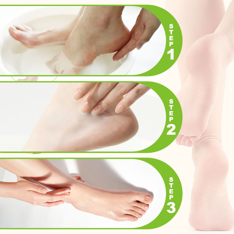 Moisturizing Foot Cream for Calluses