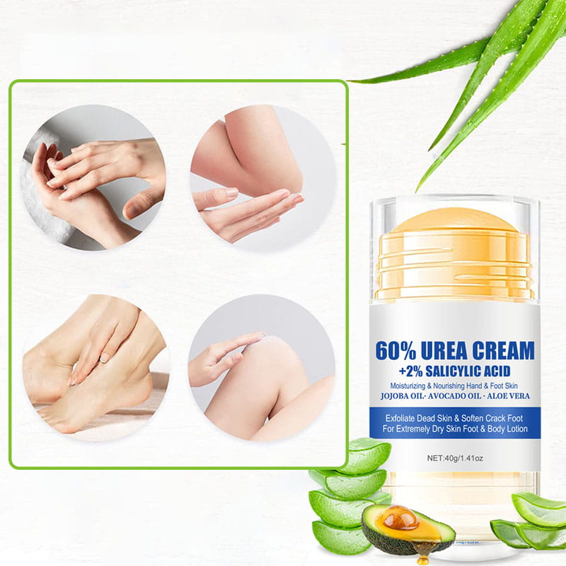 Moisturizing Foot Cream for Calluses
