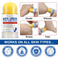 🎉42K+ Sold 🦶 Urea Foot Care Stick, Intensive Moisturizing Balm for Dry Cracked Heels & Dead Skin